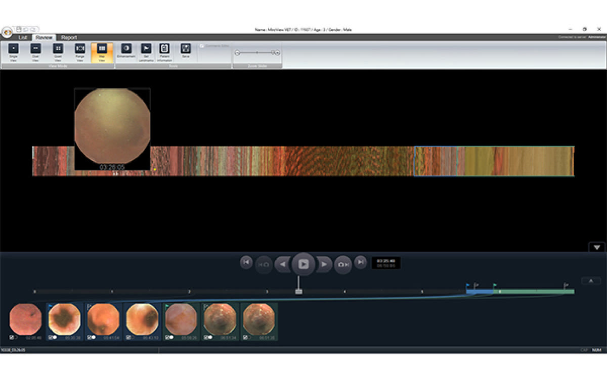 The MiroView review software, showing capsule frames along a timeline